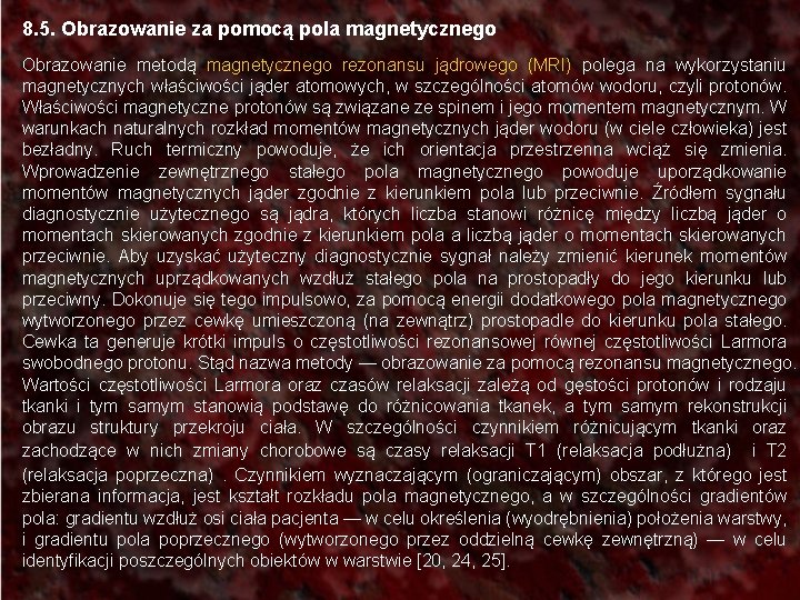 8. 5. Obrazowanie za pomocą pola magnetycznego Obrazowanie metodą magnetycznego rezonansu jądrowego (MRI) polega