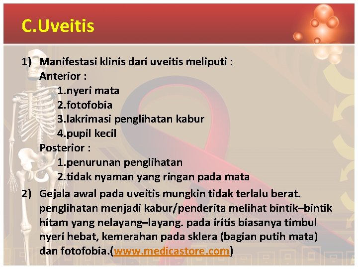 C. Uveitis 1) Manifestasi klinis dari uveitis meliputi : Anterior : 1. nyeri mata