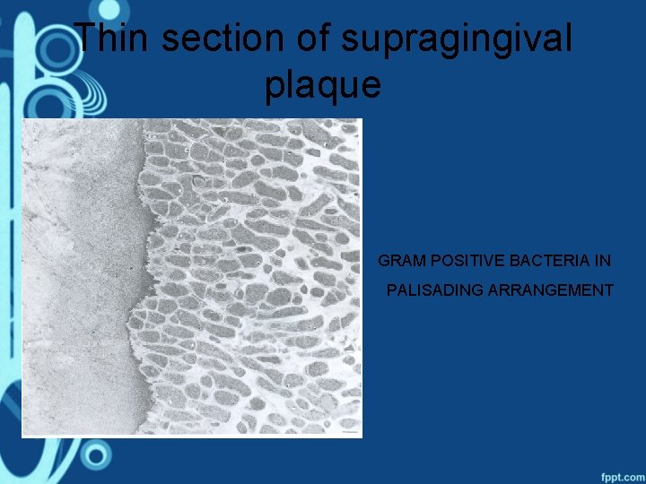 Thin section of supragingival plaque GRAM POSITIVE BACTERIA IN PALISADING ARRANGEMENT 