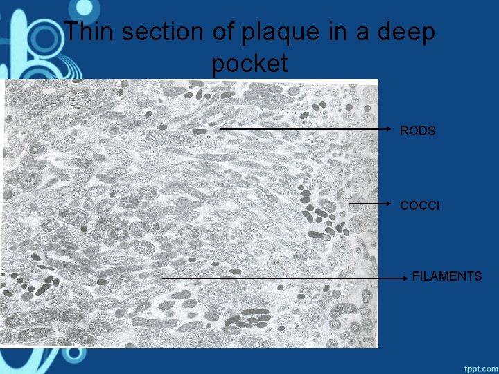 Thin section of plaque in a deep pocket RODS COCCI FILAMENTS 