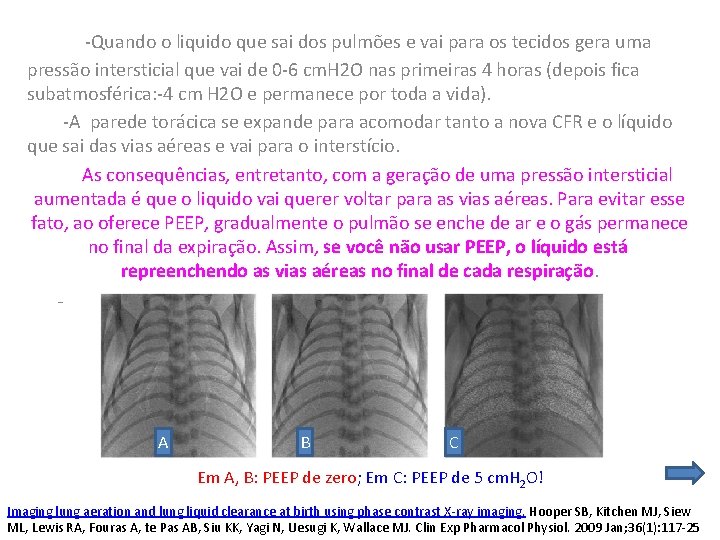  -Quando o liquido que sai dos pulmões e vai para os tecidos gera