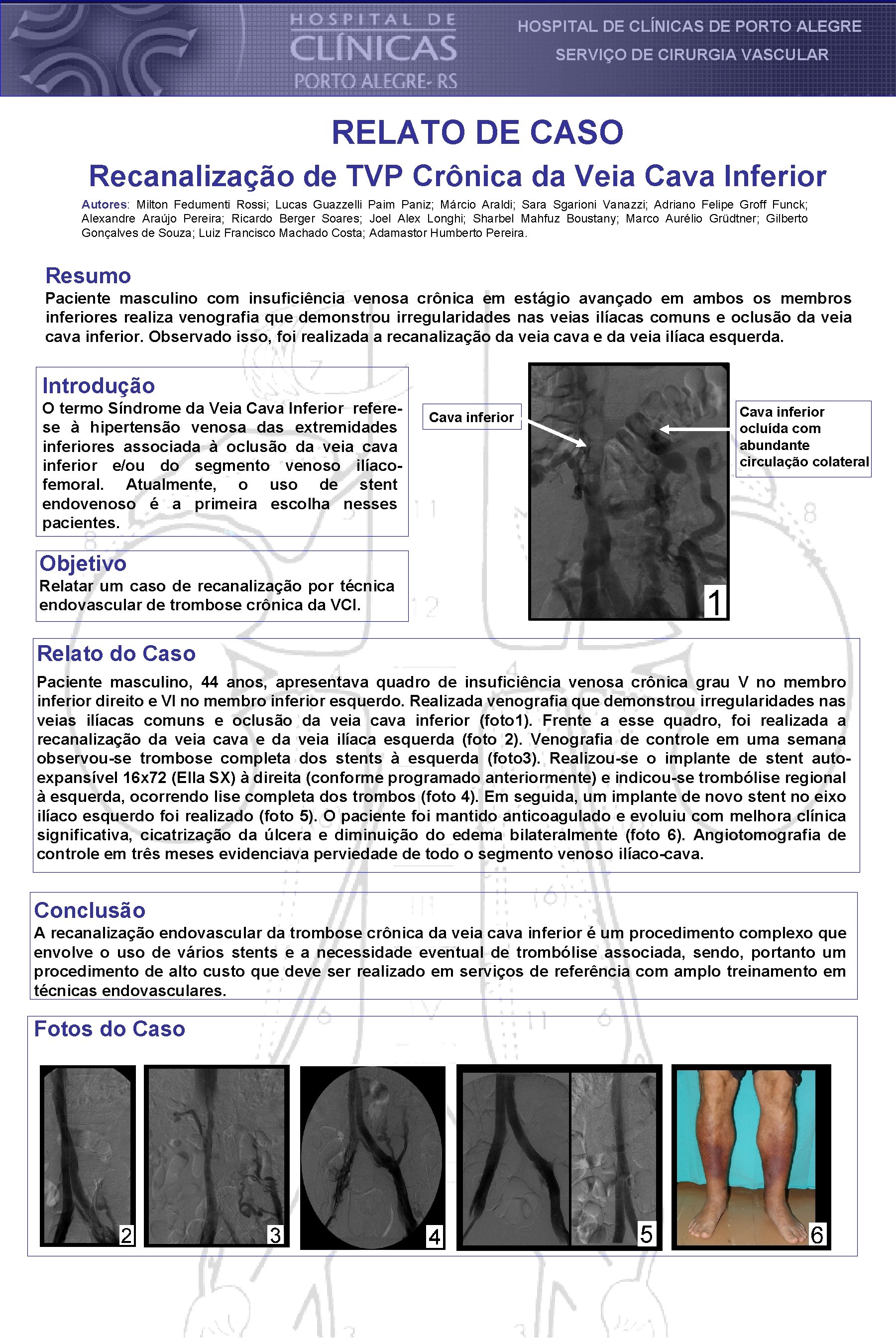 HOSPITAL DE CLÍNICAS DE PORTO ALEGRE SERVIÇO DE CIRURGIA VASCULAR RELATO DE CASO Recanalização