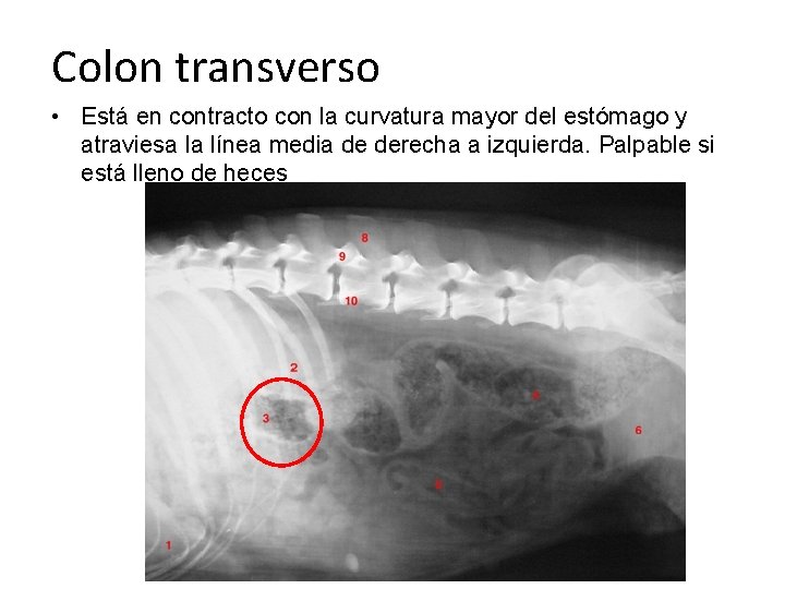 Colon transverso • Está en contracto con la curvatura mayor del estómago y atraviesa