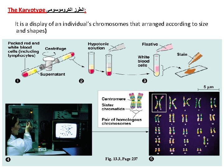 The Karyotype ﺍﻟﻄﺮﺯ ﺍﻟﻜﺮﻭﻣﻮﺳﻮﻣﻰ : It is a display of an individual’s chromosomes that The Karyotype ﺍﻟﻄﺮﺯ ﺍﻟﻜﺮﻭﻣﻮﺳﻮﻣﻰ : It is a display of an individual’s chromosomes that