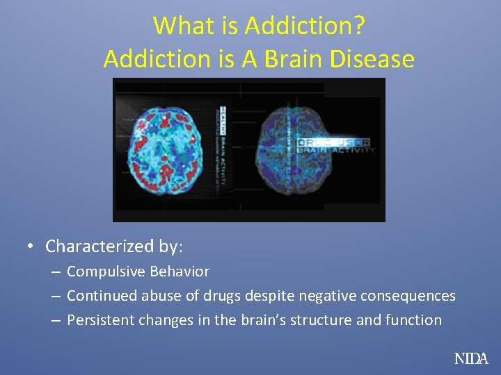 What is Addiction? Addiction is A Brain Disease • Characterized by: – Compulsive Behavior
