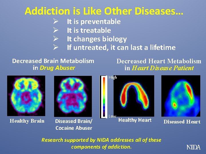 Addiction is Like Other Diseases… Ø Ø It is preventable It is treatable It