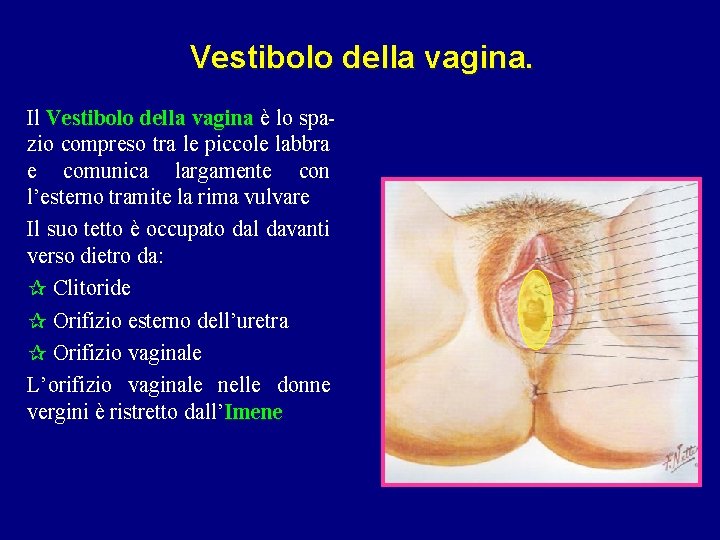 Vestibolo della vagina. Il Vestibolo della vagina è lo spazio compreso tra le piccole Vestibolo della vagina. Il Vestibolo della vagina è lo spazio compreso tra le piccole