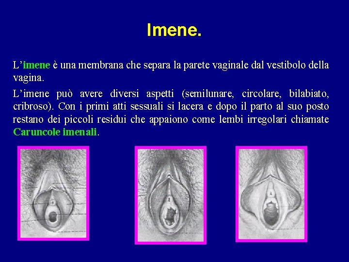 Imene. L’imene è una membrana che separa la parete vaginale dal vestibolo della vagina.