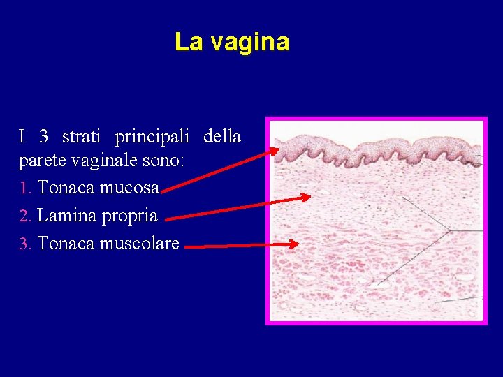 La vagina I 3 strati principali della parete vaginale sono: 1. Tonaca mucosa 2.