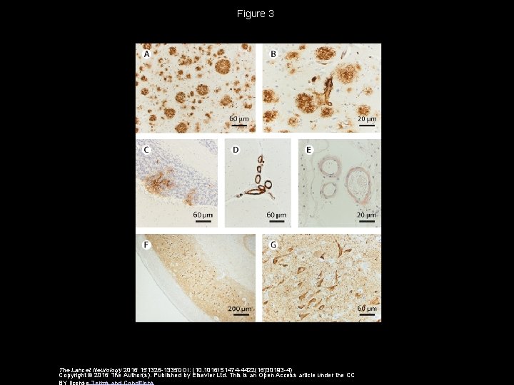 Figure 3 The Lancet Neurology 2016 151326 -1335 DOI: (10. 1016/S 1474 -4422(16)30193 -4)