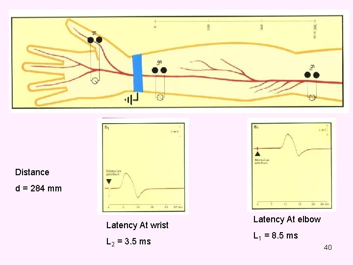 Distance d = 284 mm Latency At wrist L 2 = 3. 5 ms