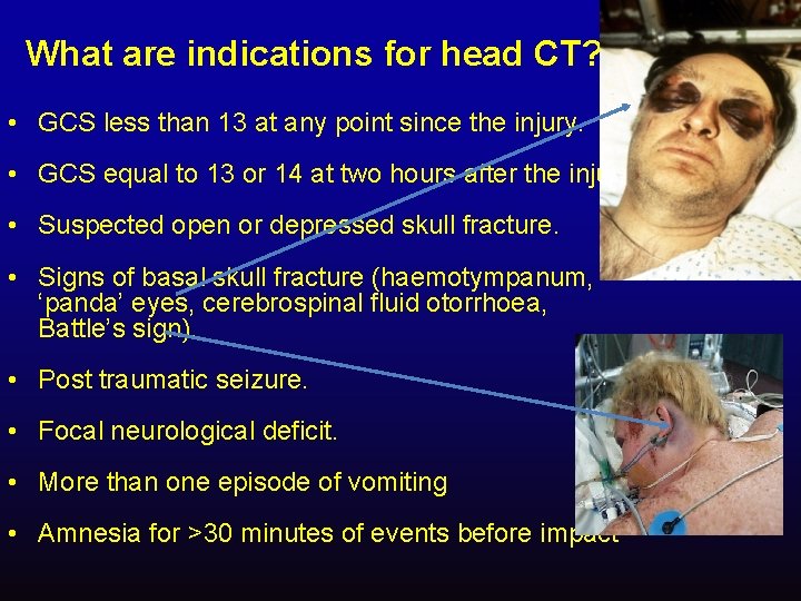 What are indications for head CT? • GCS less than 13 at any point