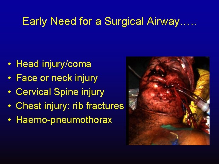 Early Need for a Surgical Airway…. . • • • Head injury/coma Face or