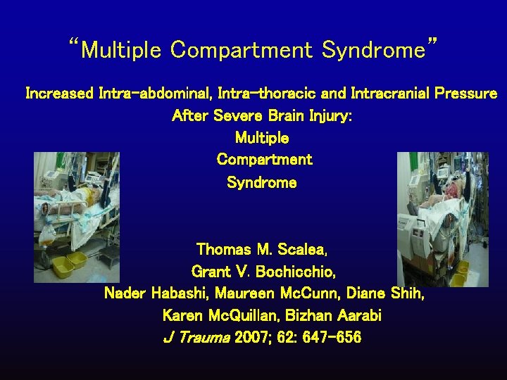 “Multiple Compartment Syndrome” Increased Intra-abdominal, Intra-thoracic and Intracranial Pressure After Severe Brain Injury: Multiple