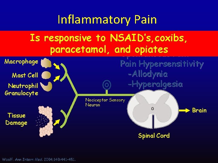 Inflammatory Pain Is responsive to NSAID’s, coxibs, paracetamol, and opiates Pain Inflammation Spontaneous Macrophage