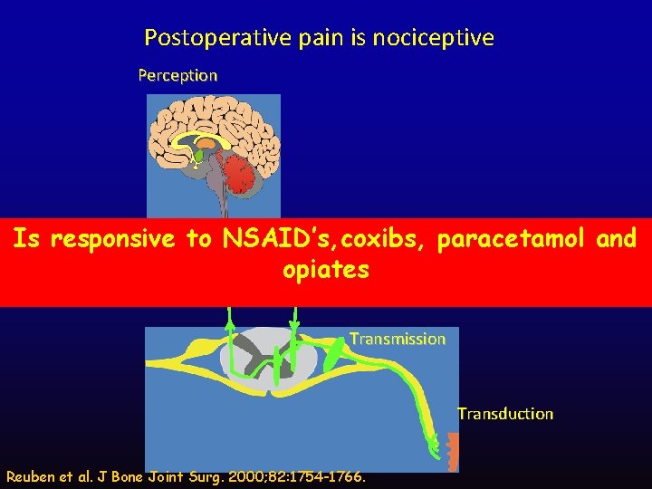 Postoperative pain is nociceptive Perception Modulation Is responsive to NSAID’s, coxibs, paracetamol and opiates
