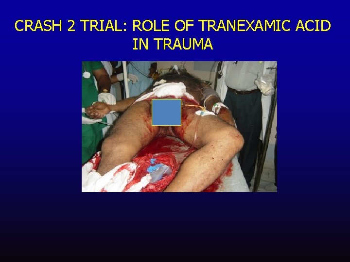 CRASH 2 TRIAL: ROLE OF TRANEXAMIC ACID IN TRAUMA 
