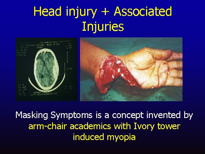 Head injury + Associated Injuries Masking Symptoms is a concept invented by arm-chair academics