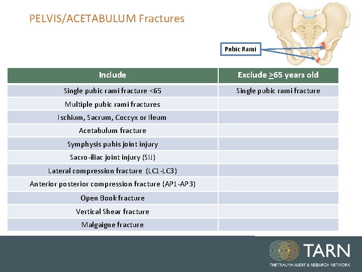 PELVIS/ACETABULUM Fractures Pubic Rami Include Exclude >65 years old Single pubic rami fracture <65 PELVIS/ACETABULUM Fractures Pubic Rami Include Exclude >65 years old Single pubic rami fracture <65