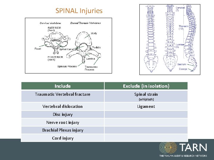 SPINAL Injuries Include Exclude (in isolation) Traumatic Vertebral fracture Spinal strain Vertebral dislocation Ligament SPINAL Injuries Include Exclude (in isolation) Traumatic Vertebral fracture Spinal strain Vertebral dislocation Ligament