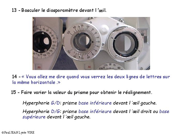 13 - Basculer le diasporamètre devant l ’œil. 14 - « Vous allez me