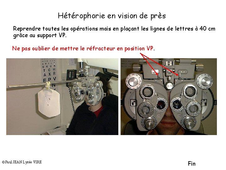 Hétérophorie en vision de près Reprendre toutes les opérations mais en plaçant les lignes