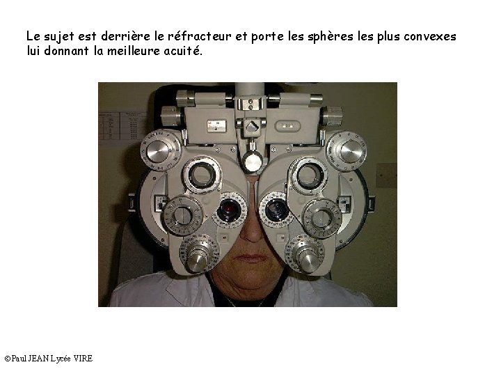 Le sujet est derrière le réfracteur et porte les sphères les plus convexes lui