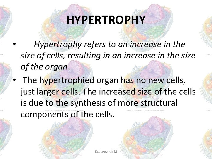 HYPERTROPHY Hypertrophy refers to an increase in the size of cells, resulting in an HYPERTROPHY Hypertrophy refers to an increase in the size of cells, resulting in an