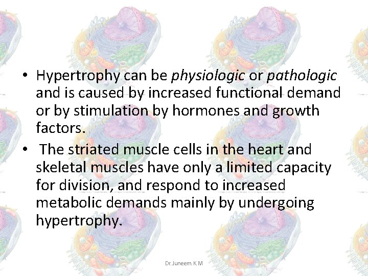• Hypertrophy can be physiologic or pathologic and is caused by increased functional • Hypertrophy can be physiologic or pathologic and is caused by increased functional