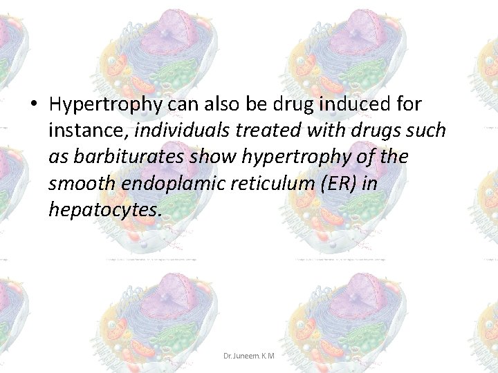 • Hypertrophy can also be drug induced for instance, individuals treated with drugs • Hypertrophy can also be drug induced for instance, individuals treated with drugs