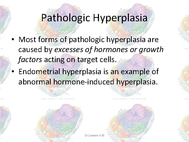 Pathologic Hyperplasia • Most forms of pathologic hyperplasia are caused by excesses of hormones Pathologic Hyperplasia • Most forms of pathologic hyperplasia are caused by excesses of hormones