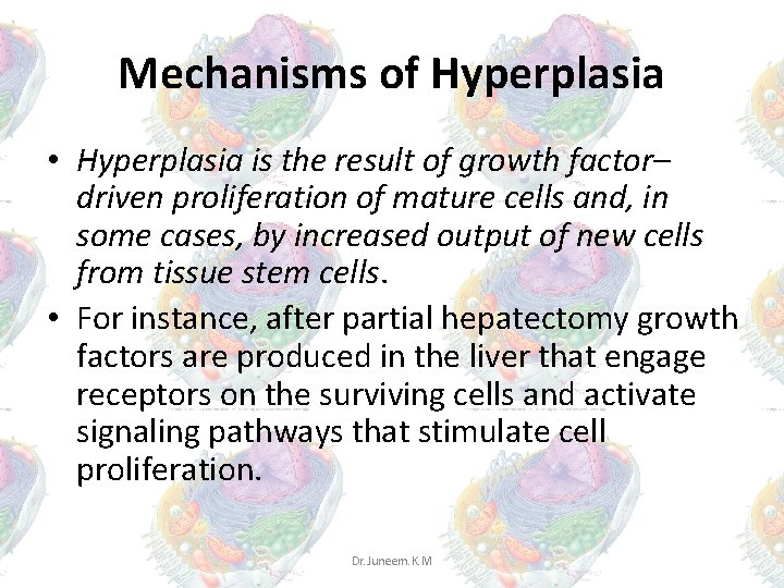 Mechanisms of Hyperplasia • Hyperplasia is the result of growth factor– driven proliferation of Mechanisms of Hyperplasia • Hyperplasia is the result of growth factor– driven proliferation of