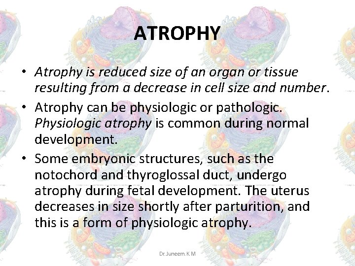ATROPHY • Atrophy is reduced size of an organ or tissue resulting from a ATROPHY • Atrophy is reduced size of an organ or tissue resulting from a