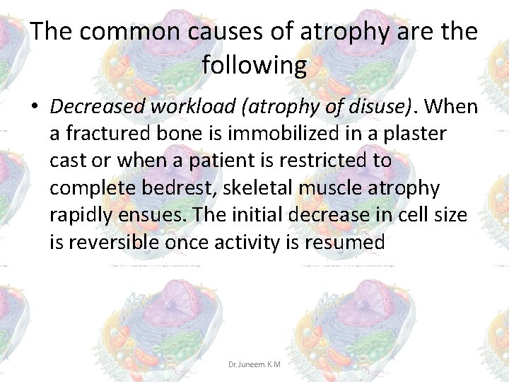 The common causes of atrophy are the following • Decreased workload (atrophy of disuse). The common causes of atrophy are the following • Decreased workload (atrophy of disuse).