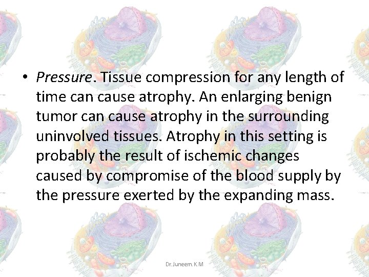 • Pressure. Tissue compression for any length of time can cause atrophy. An • Pressure. Tissue compression for any length of time can cause atrophy. An