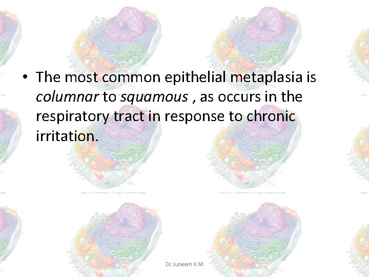 • The most common epithelial metaplasia is columnar to squamous , as occurs • The most common epithelial metaplasia is columnar to squamous , as occurs