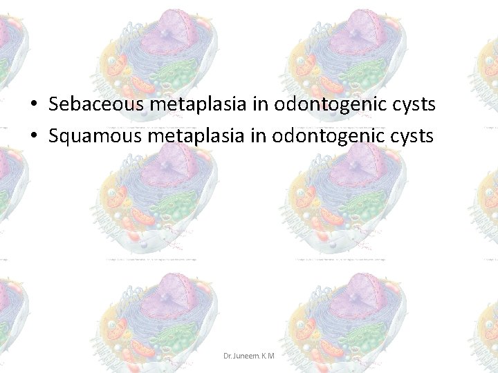 • Sebaceous metaplasia in odontogenic cysts • Squamous metaplasia in odontogenic cysts Dr. • Sebaceous metaplasia in odontogenic cysts • Squamous metaplasia in odontogenic cysts Dr.