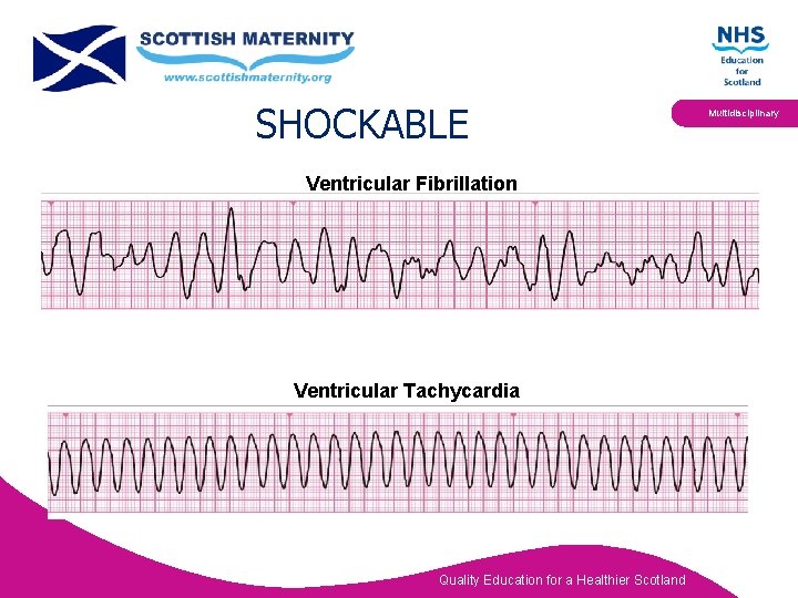 SHOCKABLE Ventricular Fibrillation Ventricular Tachycardia Quality Education for a Healthier Scotland Multidisciplinary 