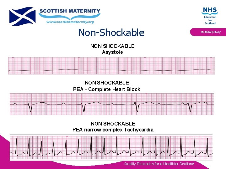 Non-Shockable NON SHOCKABLE Asystole NON SHOCKABLE PEA - Complete Heart Block NON SHOCKABLE PEA