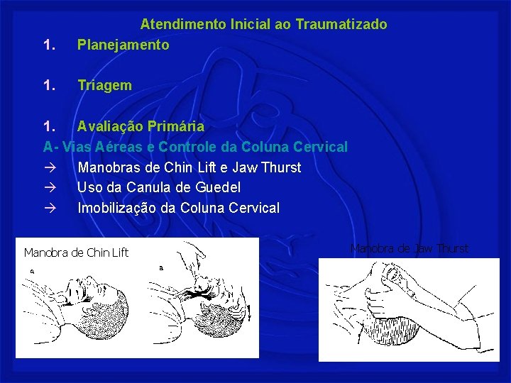 1. Atendimento Inicial ao Traumatizado Planejamento 1. Triagem 1. Avaliação Primária A- Vias Aéreas