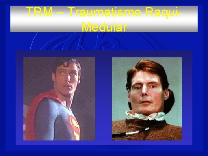 TRM – Traumatismo Raqui. Medular 