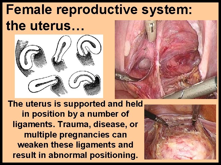 Female reproductive system: the uterus… The uterus is supported and held in position by