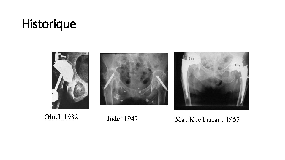 Historique Gluck 1932 Judet 1947 Mac Kee Farrar : 1957 