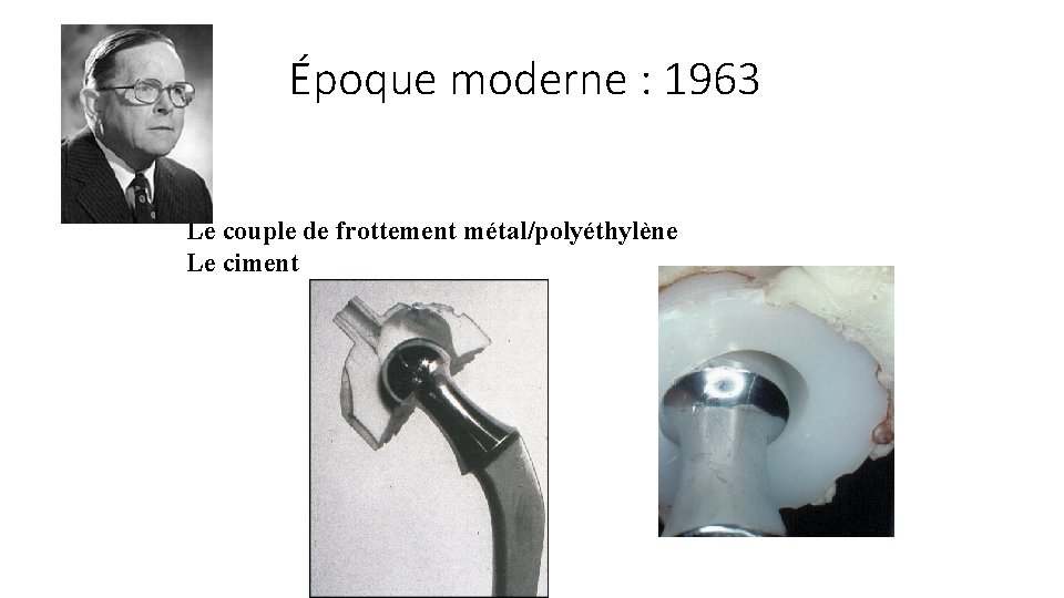 Époque moderne : 1963 Le couple de frottement métal/polyéthylène Le ciment 