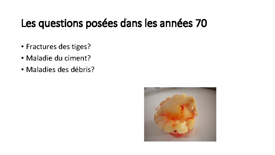 Les questions posées dans les années 70 • Fractures des tiges? • Maladie du