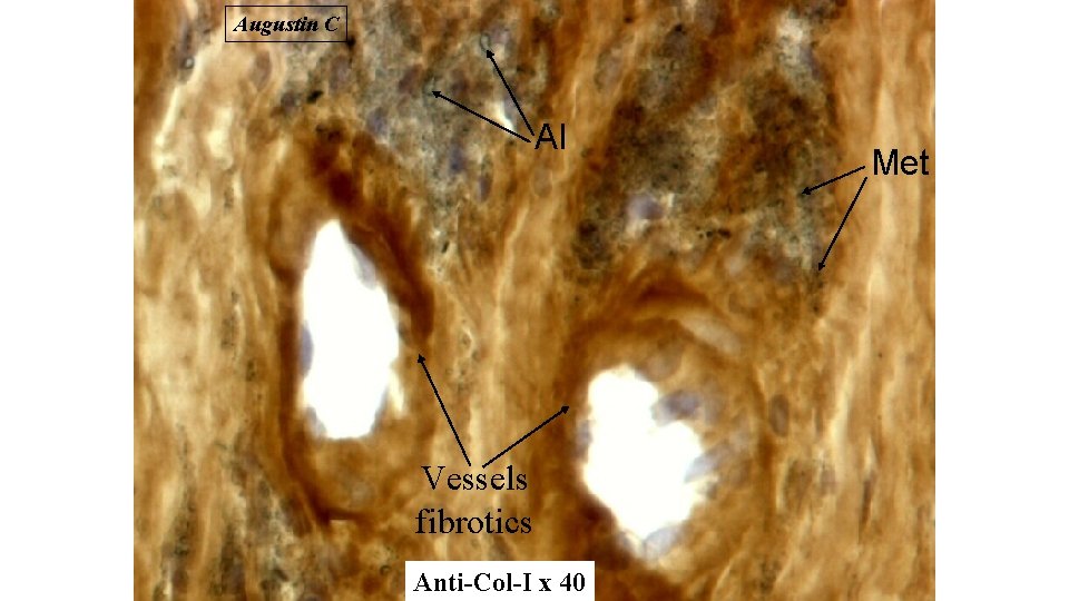 Augustin C Al Vessels fibrotics Anti-Col-I x 40 Met 