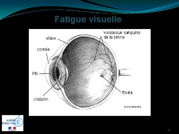 Fatigue visuelle Source Wikipédia 15 