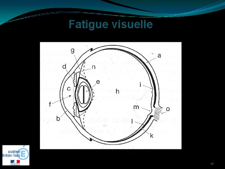 Fatigue visuelle 16 