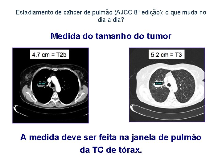 Estadiamento de ca ncer de pulma o (AJCC 8 a edic a o): o