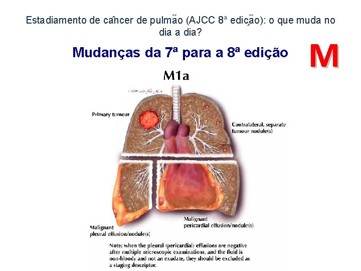 Estadiamento de ca ncer de pulma o (AJCC 8 a edic a o): o